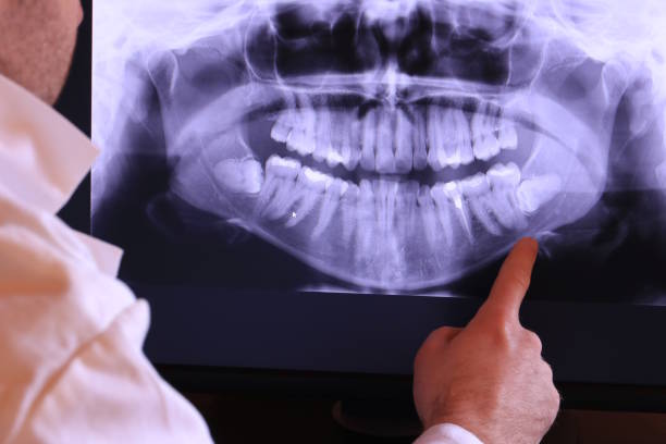 Best Emergency Tooth Extraction in Winlock, WA