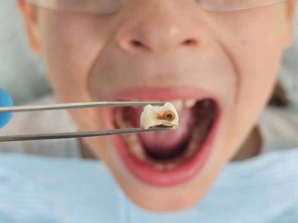 Best Same-Day Emergency Dental Services in Winlock, WA